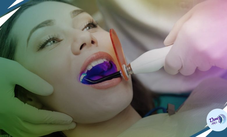 ما أفضل الطرق لتبييض الأسنان؟